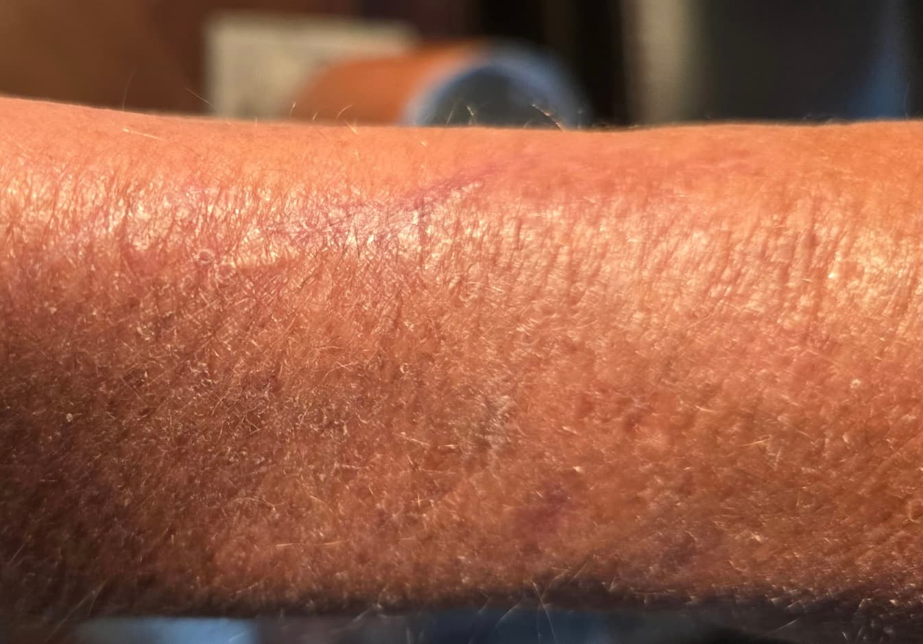 After - Skin Wound Recovery