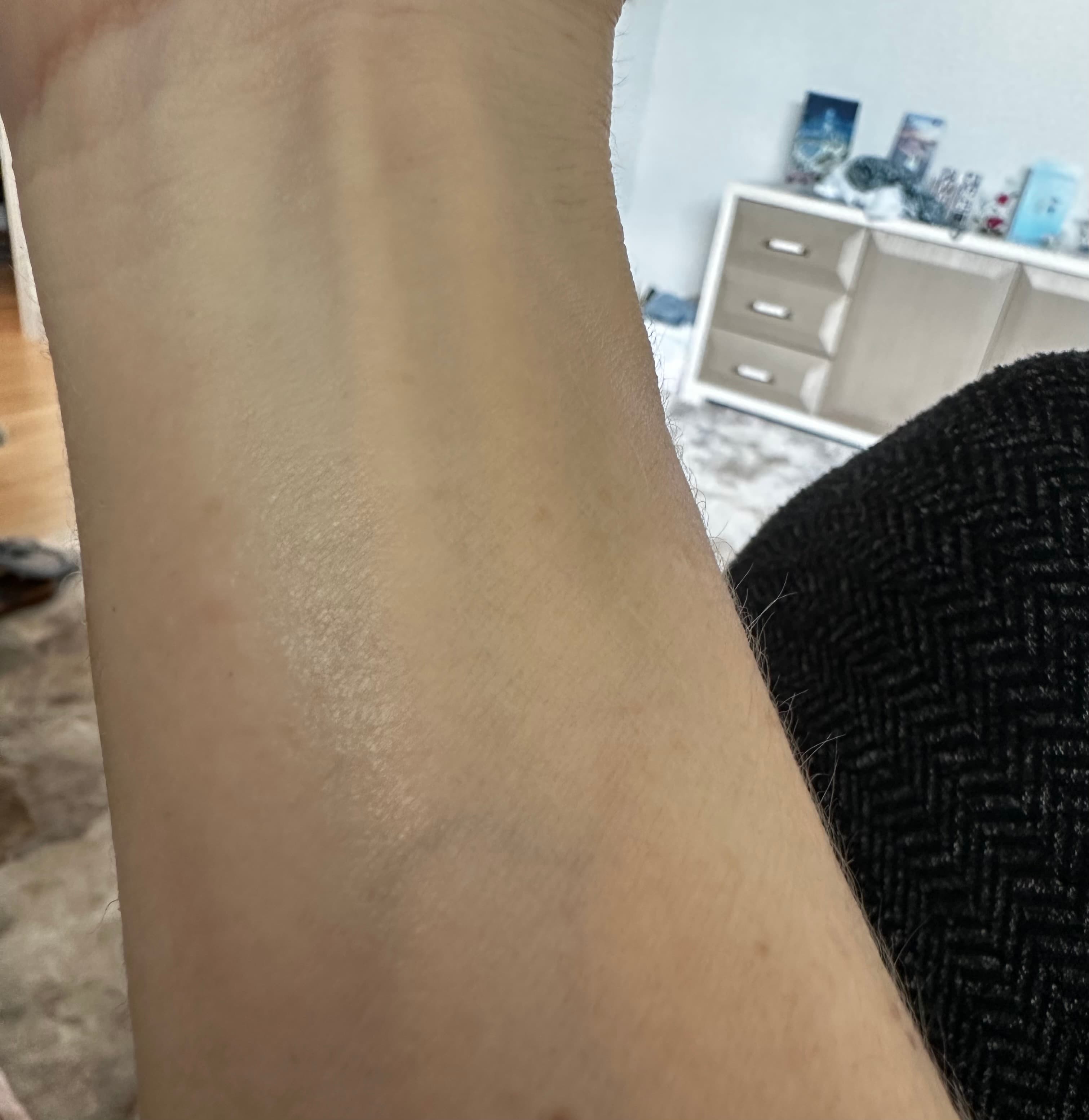 After - Skin Irritation Relief