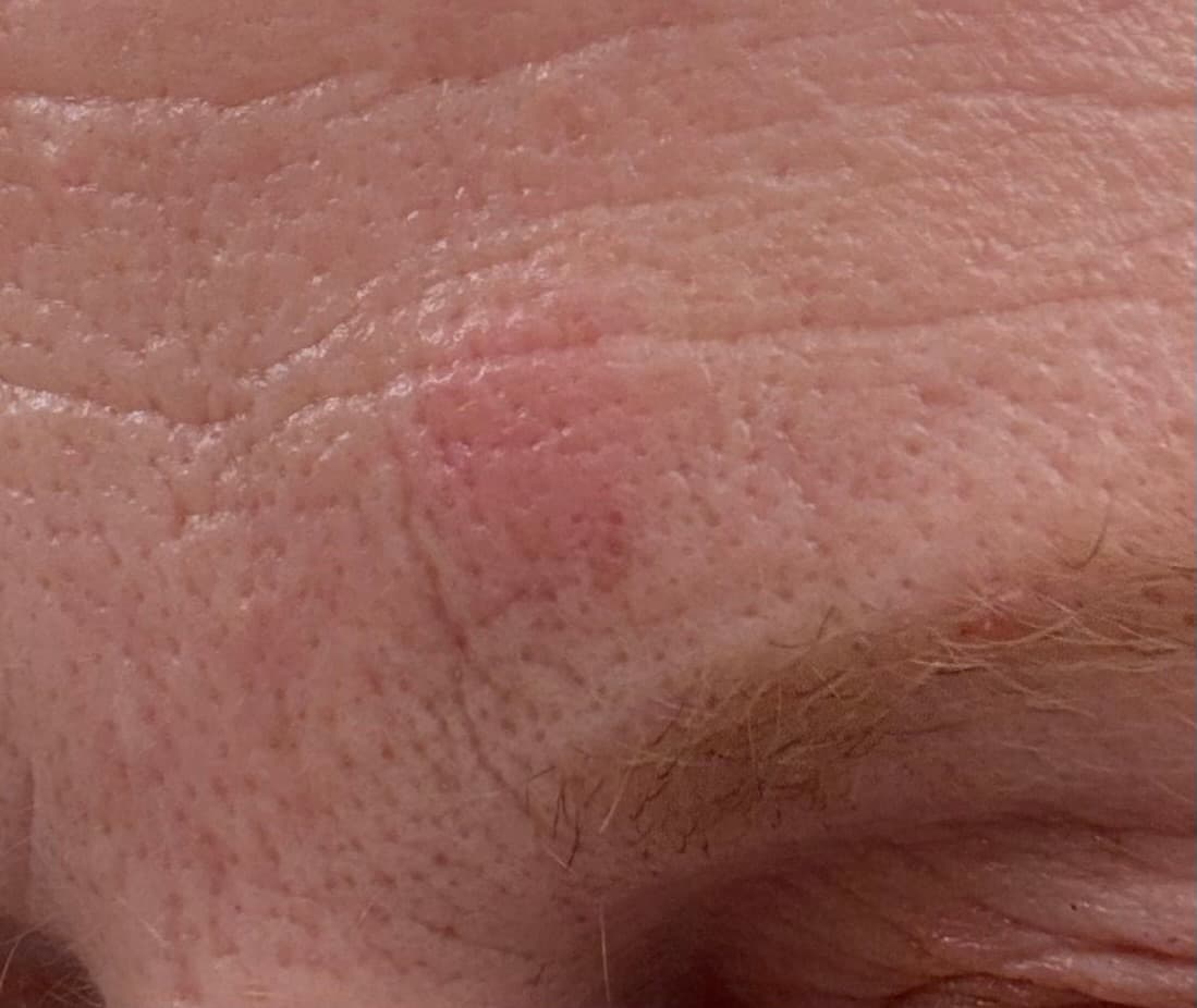 Before - Hand Skin Healing